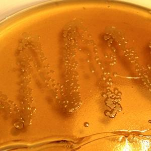Колонии бактерий на питательной среде
